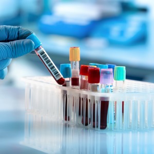 Laboratory in Shoreline WA Laboratory in Shoreline WA