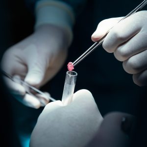 Minor Procedures in Shoreline WA Minor Procedures in Shoreline WA
