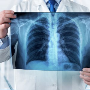 X Rays in Shoreline WA X Rays in Shoreline WA